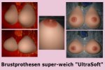 brustprothese-superweich-ultrasoft-150.jpg